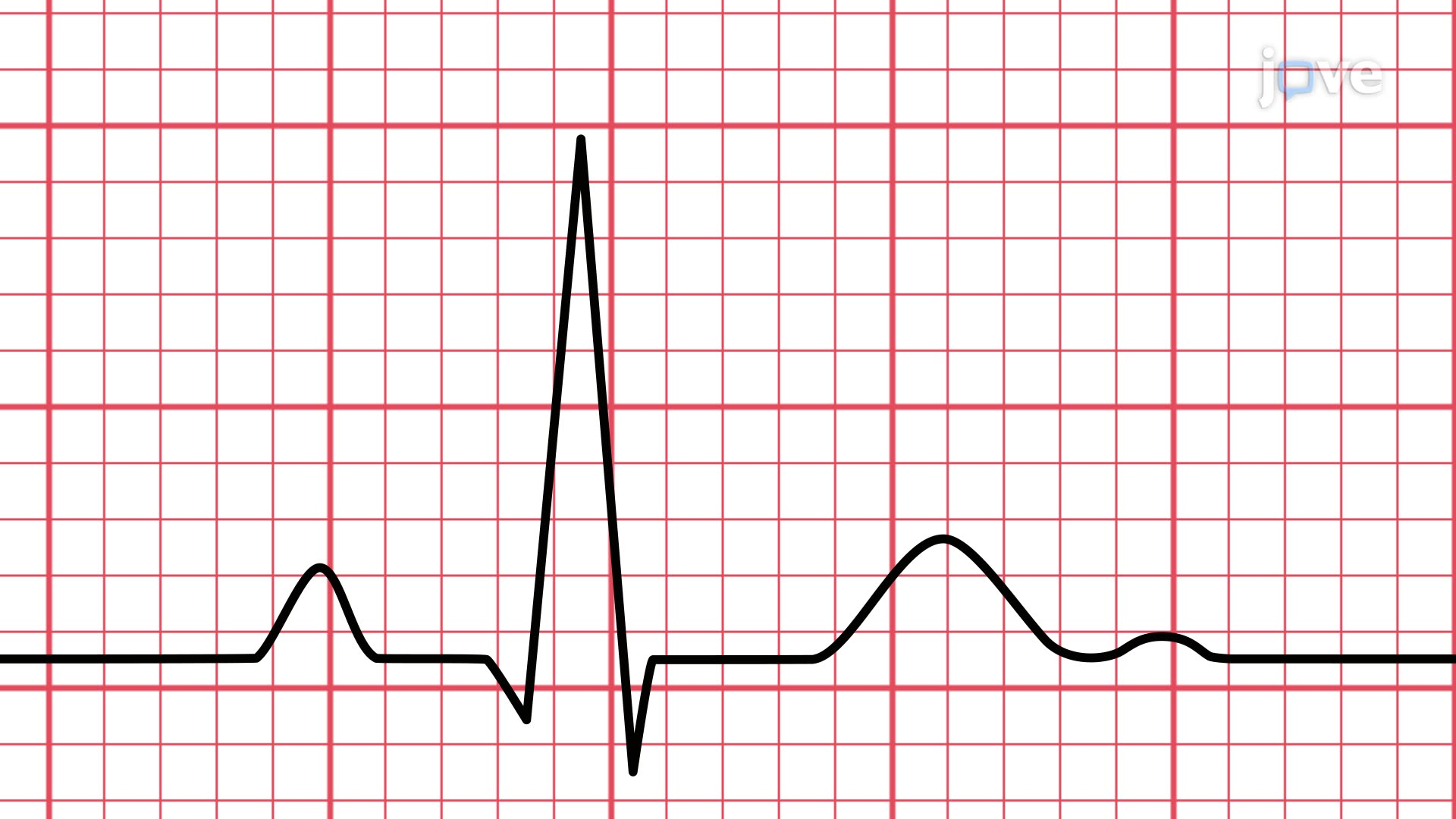 Pre operative Risk Assessment - We provide comprehensive pre-operative medical and cardiac risk assessments to h...